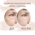 Кинезио тейп для обличчя ARES Beauty (Південна Корея)